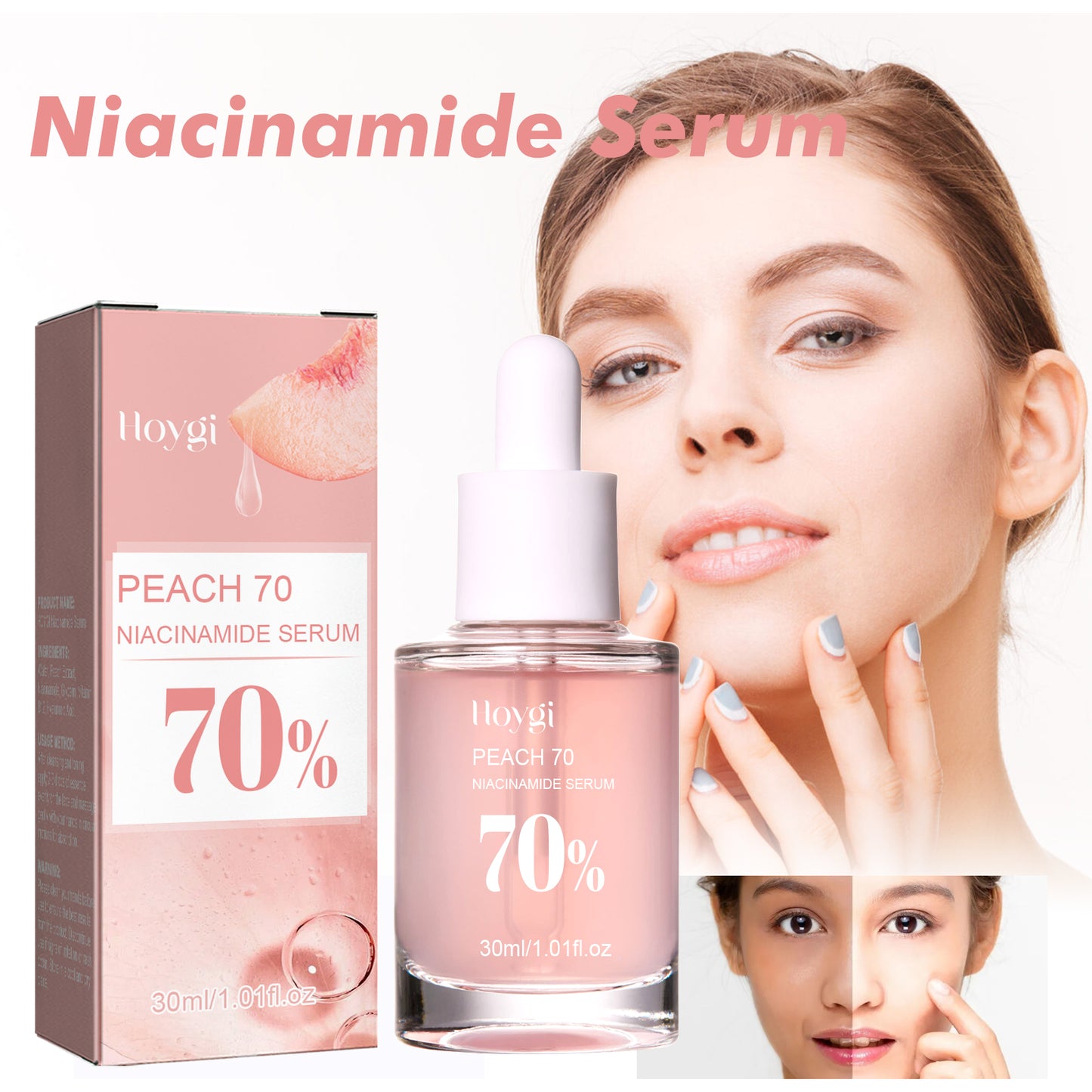 Niacinamide essence tightens and moisturizes pores, reduces acne marks, fine lines and spots, rejuvenates and hydrates the skin, and whitens the skin