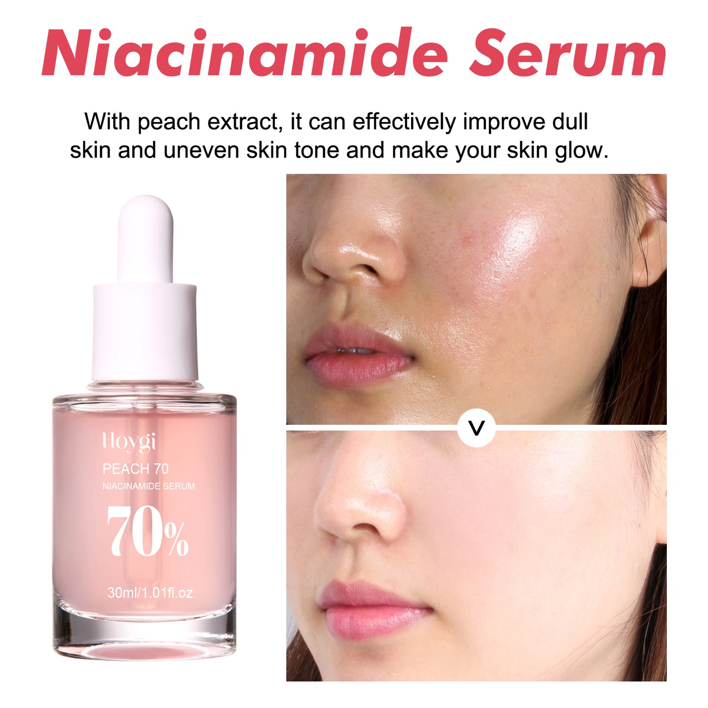 Niacinamide essence tightens and moisturizes pores, reduces acne marks, fine lines and spots, rejuvenates and hydrates the skin, and whitens the skin