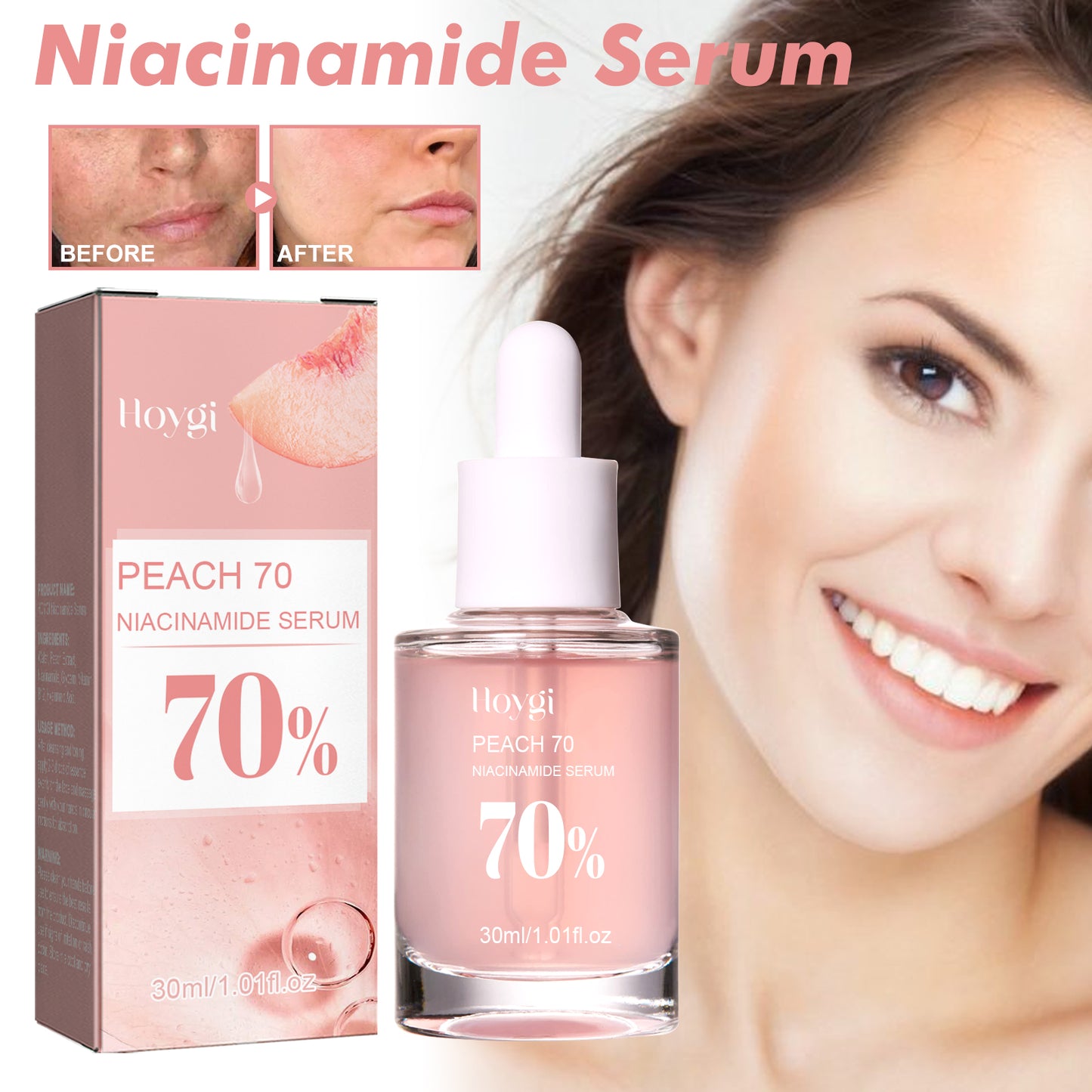 Niacinamide essence tightens and moisturizes pores, reduces acne marks, fine lines and spots, rejuvenates and hydrates the skin, and whitens the skin