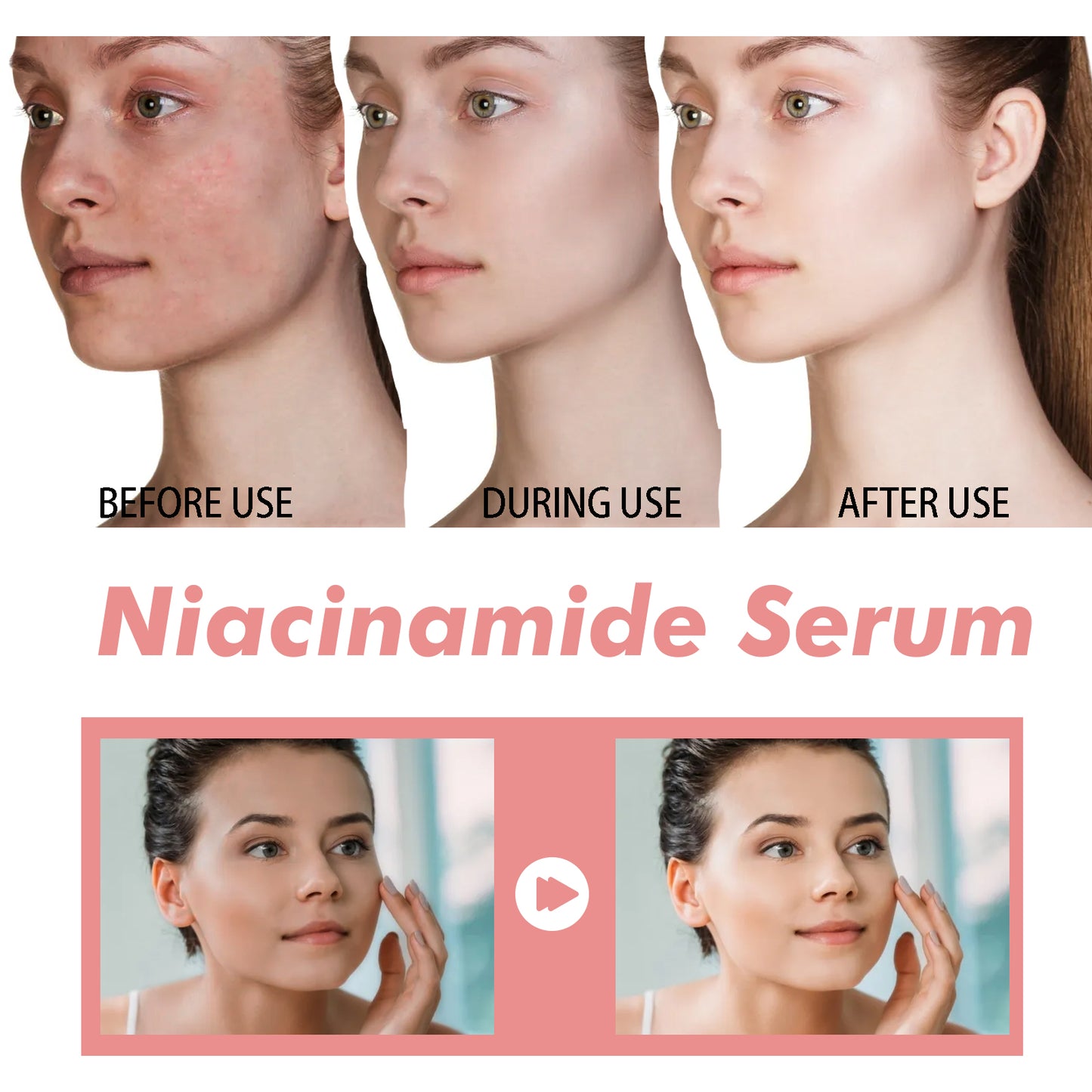 Niacinamide essence tightens and moisturizes pores, reduces acne marks, fine lines and spots, rejuvenates and hydrates the skin, and whitens the skin