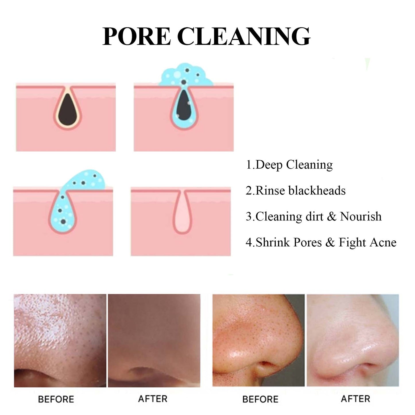 Blackhead Cleansing Mud Mask Cleans Blackheads, Skin Oil, Tightens Pores, Cleanses and Moisturizes Skin